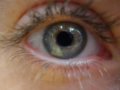 eye see you