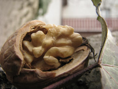 Trepanacja