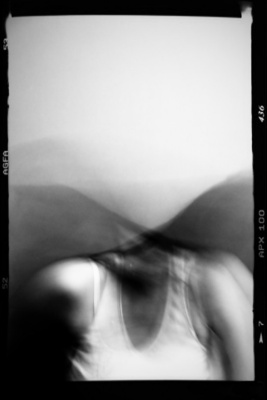 Schizofremia