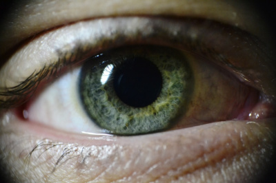 Eye