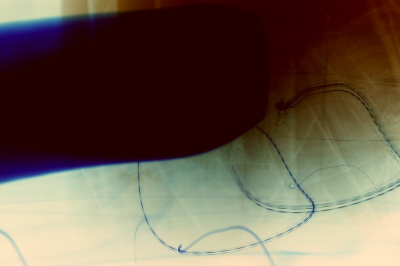No. XVIII