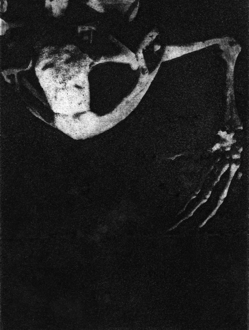 Frog Bones (For the Coming Extinctions)